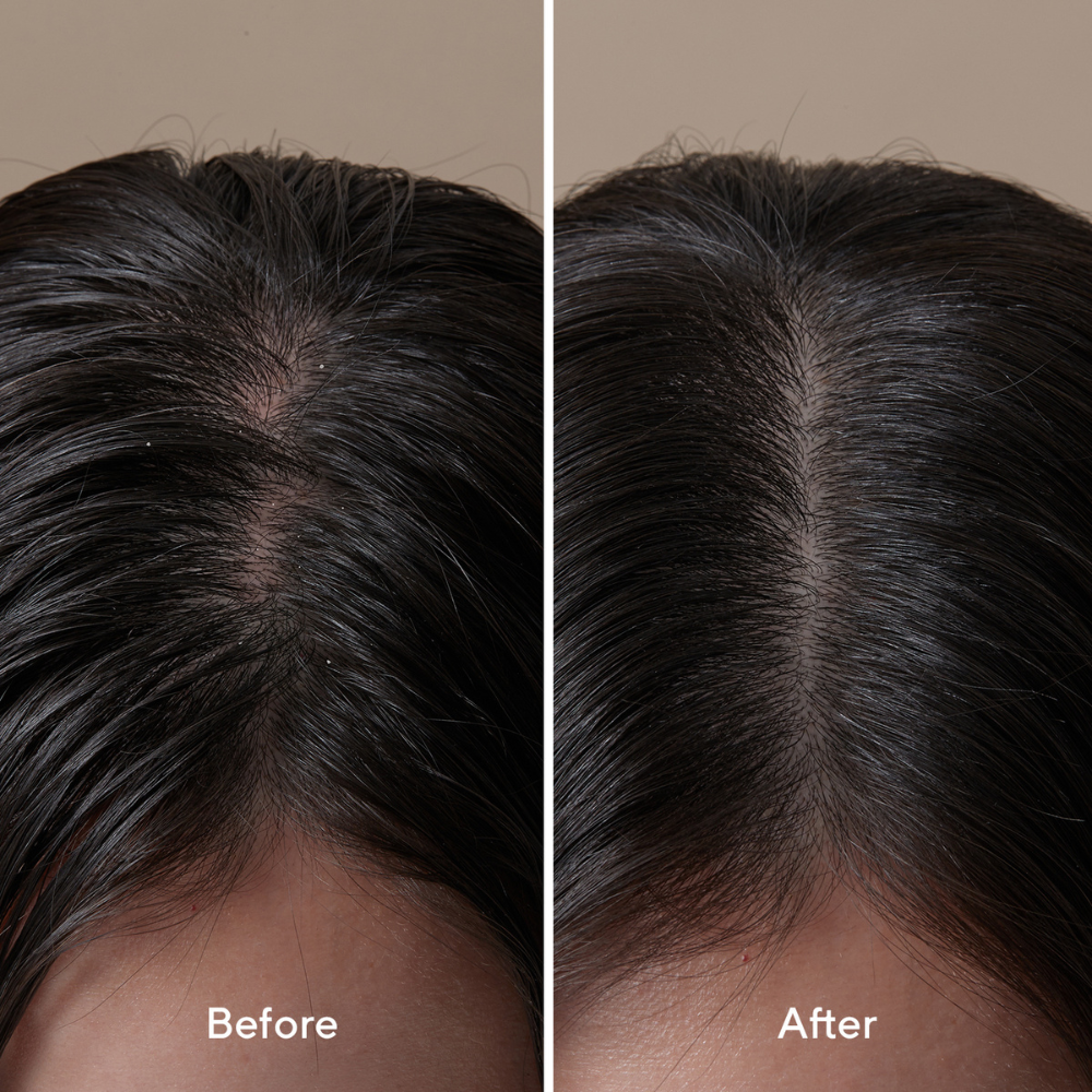 AROMATICA Rosemary Root Enhancer Water Spray for Hair Growth 95.120g